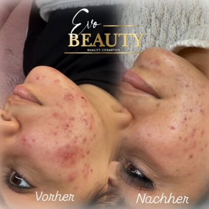 Evo Beauty Bielefeld
